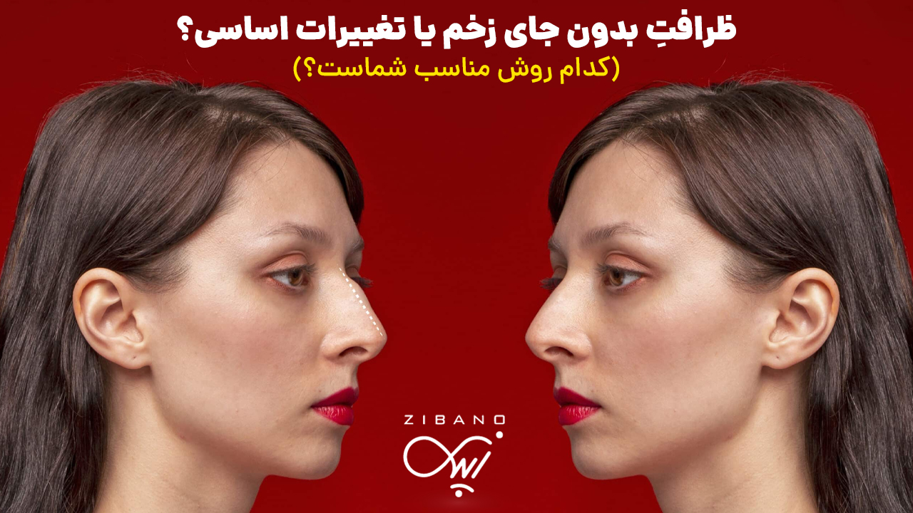 jarahii03